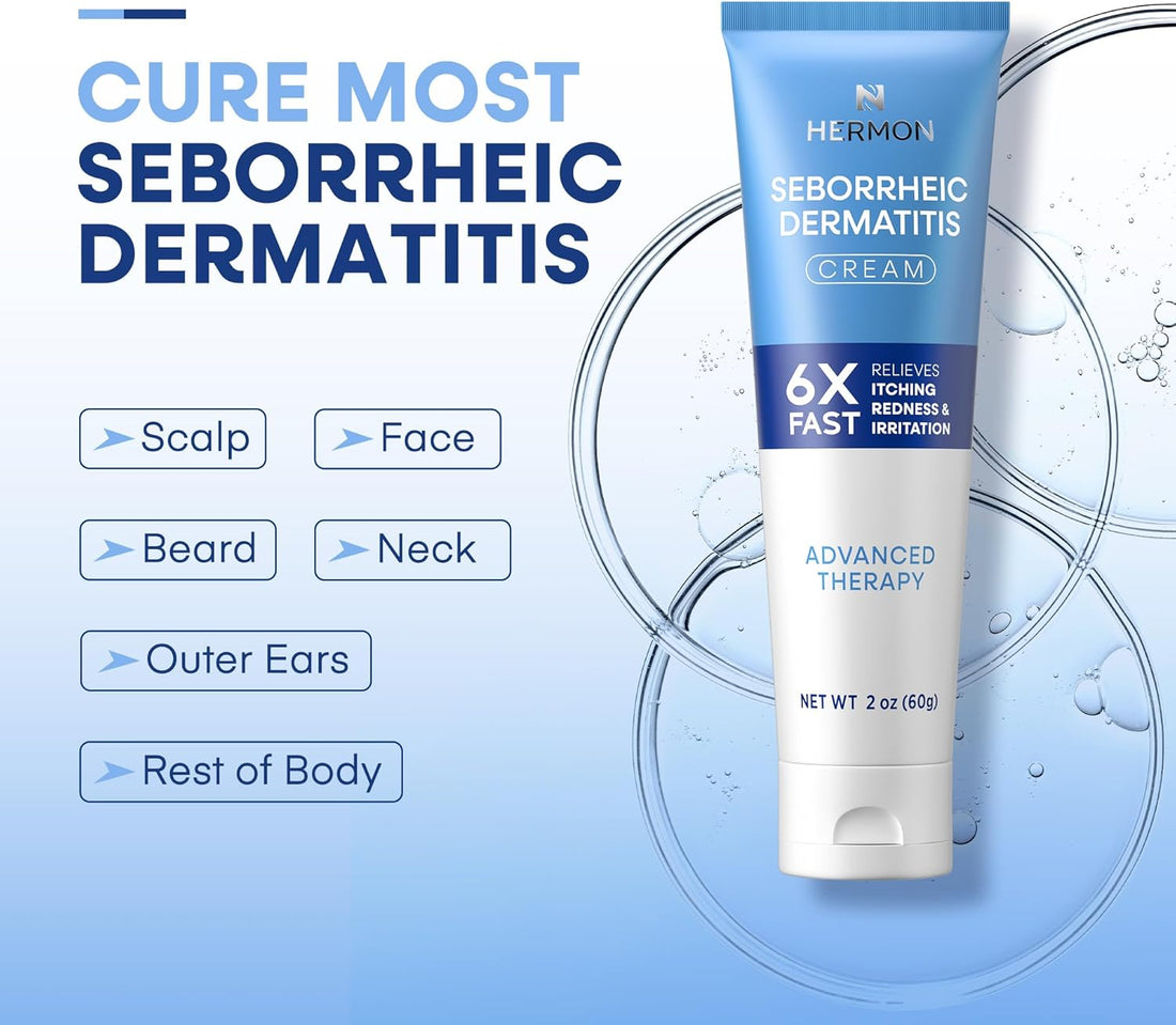 Seborrheic Dermatitis Scalp Treatment Cream