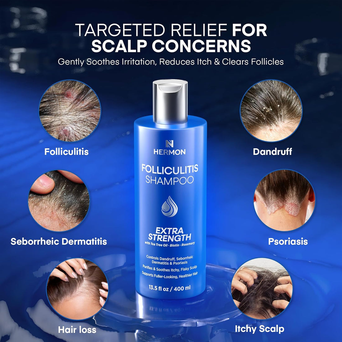 Folliculitis Relief Shampoo