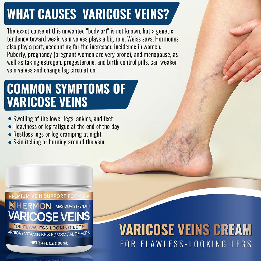 Extra Large Size Varicose Veins Cream