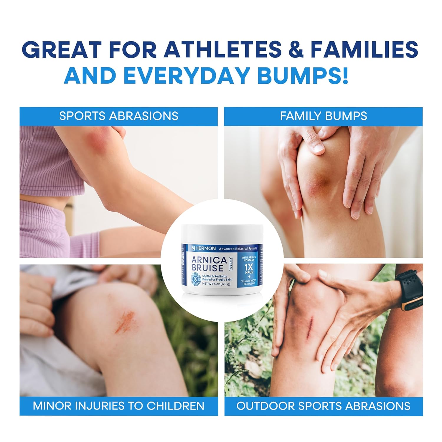 Arnica Bruise Cream Extra Strength – Hermon