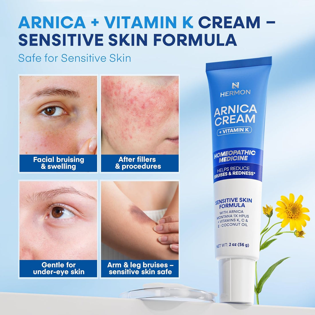 Hermon Arnica Bruise Cream with Vitamin K